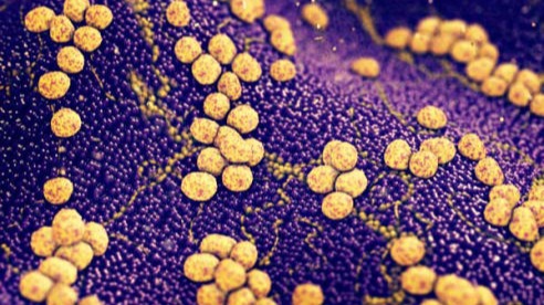 Control de plagas de microorganismos patógenos Staphylococos-Aureus